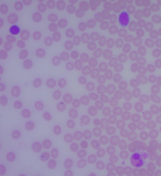 瑞氏-吉姆薩圖.png 瑞氏-吉姆薩圖.png