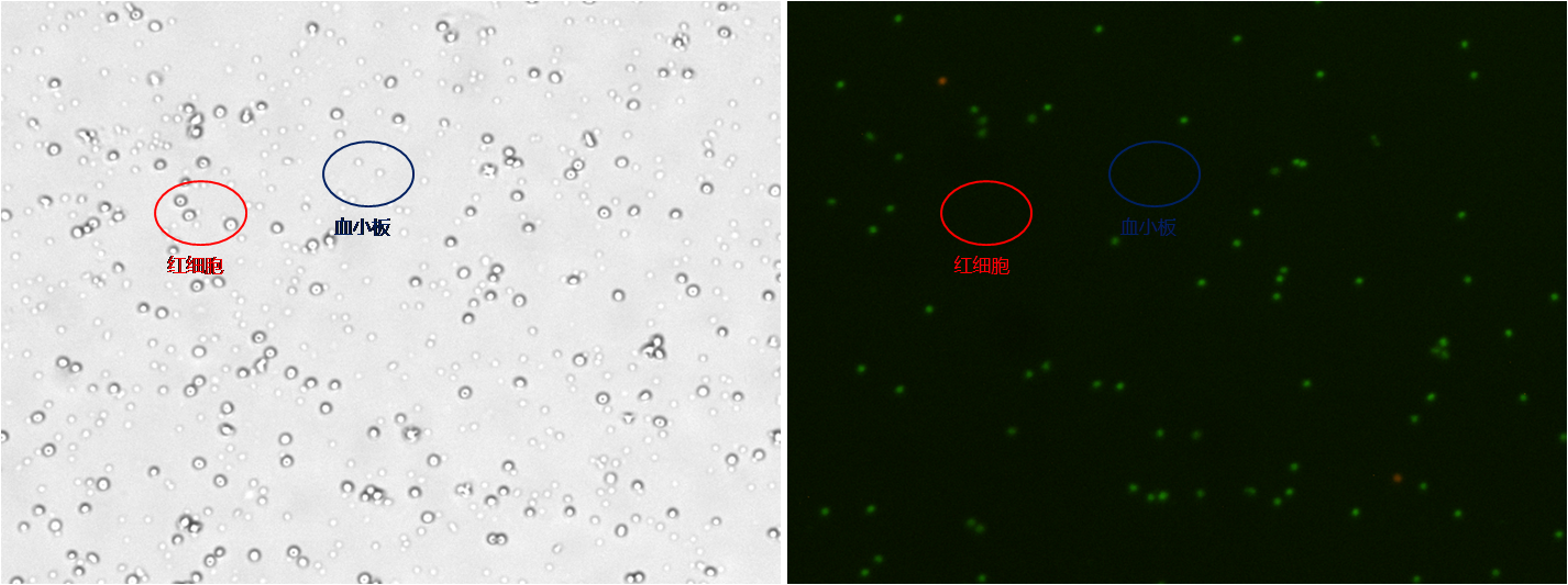 PBMC-COMBINED.png PBMC-COMBINED.png